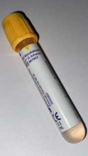 Hépatite B - Anticorps anti HBs (ACHBs) main image