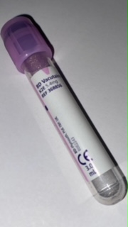 HBA1C (Hémoglobine glyquée)-image