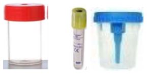ECBU (Examen cytobactériologique des urines)-image